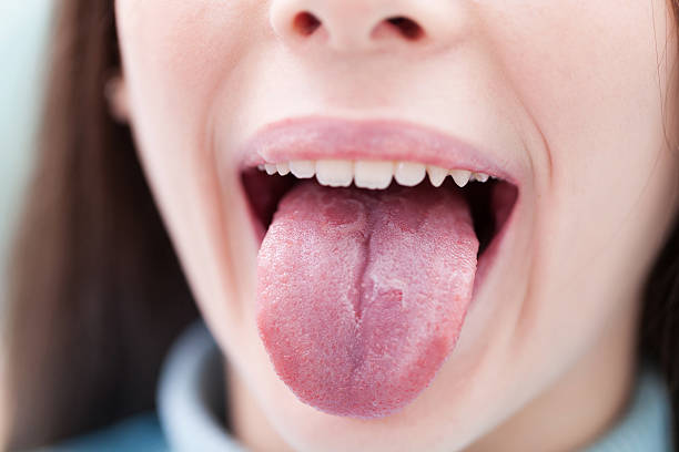 ¿Por qué salen granos en la lengua? Causas